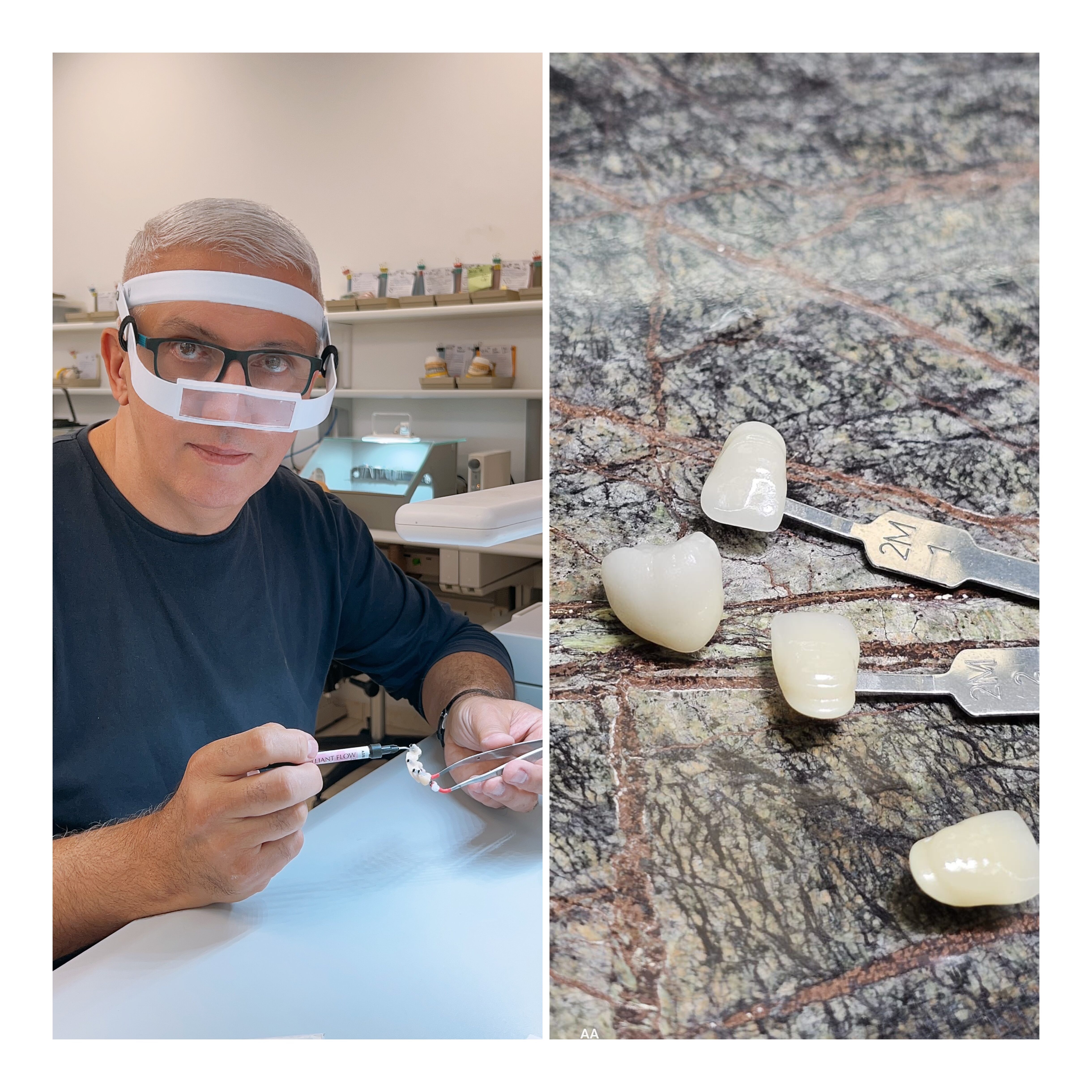 vita 3d master sistem profesional pentru culoarea dintilor