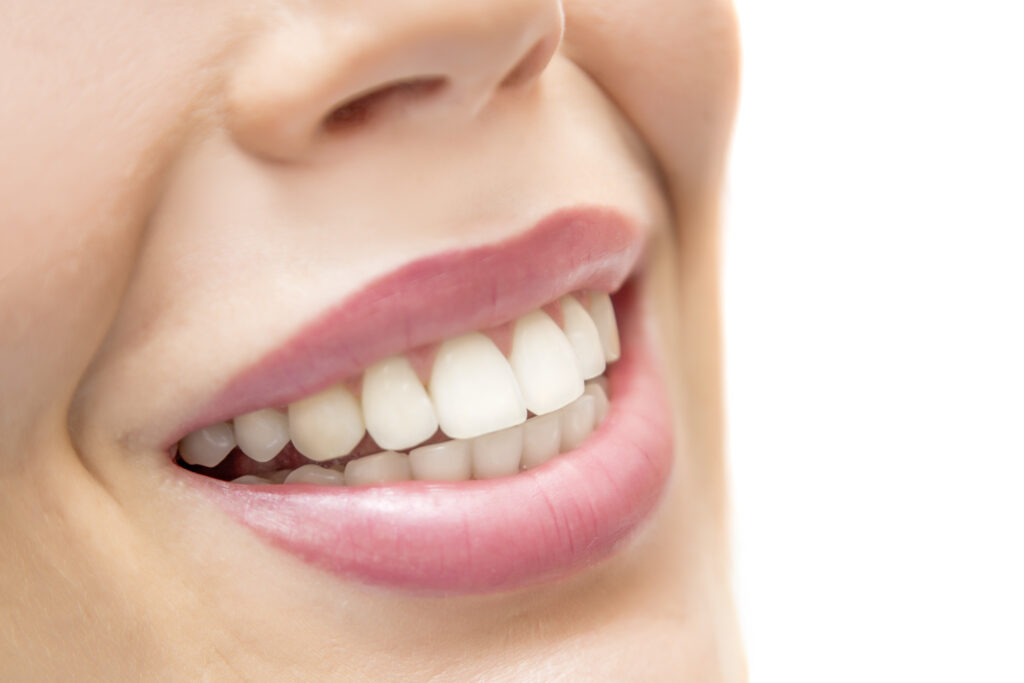 estetică dentară